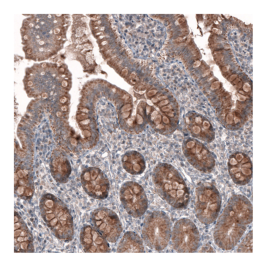 Atlas Antibodies Anti-FASTKD1 Antibody