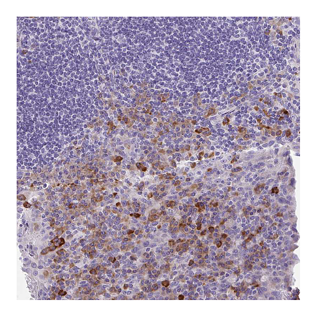 Atlas Antibodies Anti-FASLG Antibody