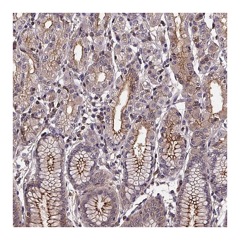 Atlas Antibodies Anti-FASTKD3 Antibody