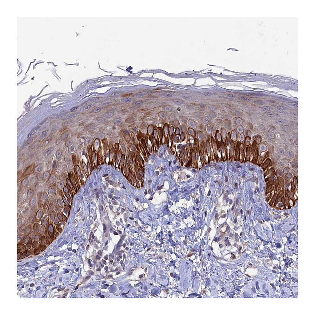 Atlas Antibodies Anti-FASTKD5 Antibody