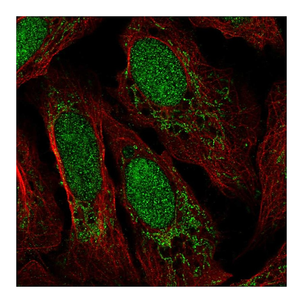 Atlas Antibodies Anti-FASTKD3 Antibody