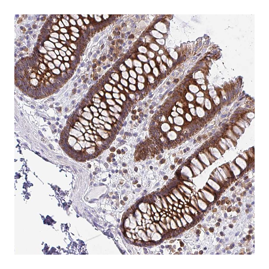 Atlas Antibodies Anti-FAU Antibody