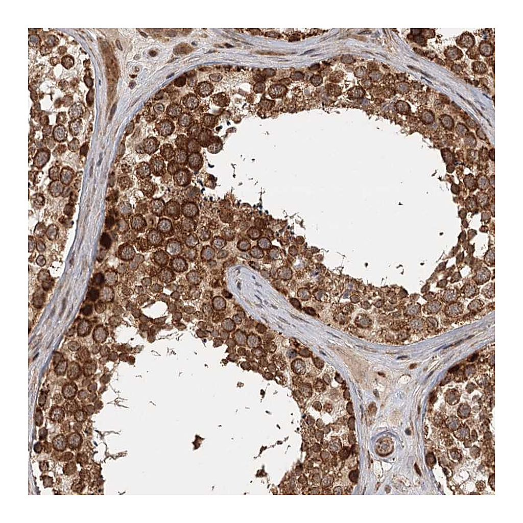 Atlas Antibodies Anti-FAXC Antibody