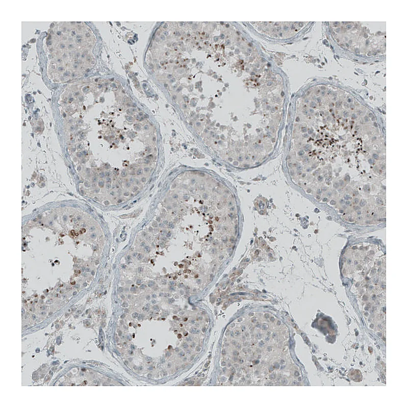 Atlas Antibodies Anti-FBF1 Antibody