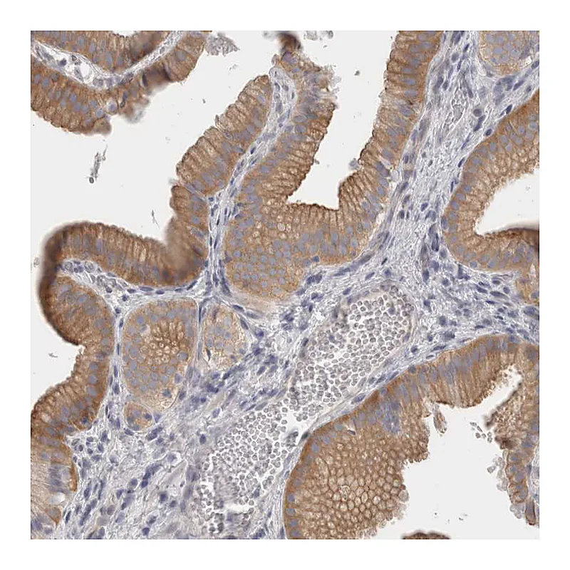Atlas Antibodies Anti-FBLIM1 Antibody