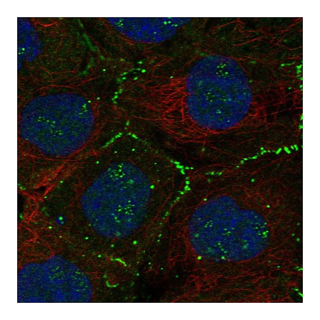 Atlas Antibodies Anti-FBLIM1 Antibody
