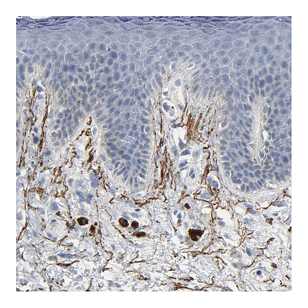Atlas Antibodies Anti-FBLN5 Antibody
