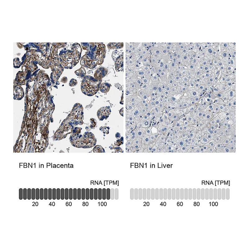 Atlas Antibodies Anti-FBN1 Antibody