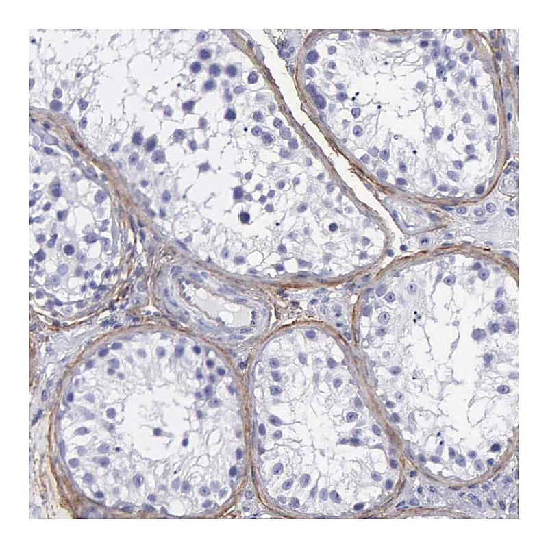 Atlas Antibodies Anti-FBLN5 Antibody
