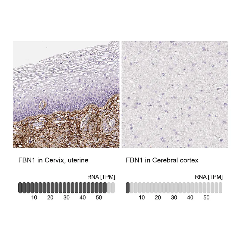 Atlas Antibodies Anti-FBN1 Antibody