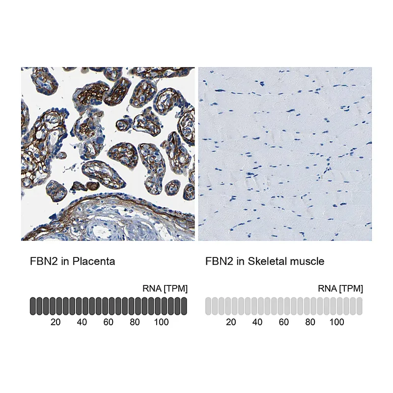 Atlas Antibodies Anti-FBN2 Antibody