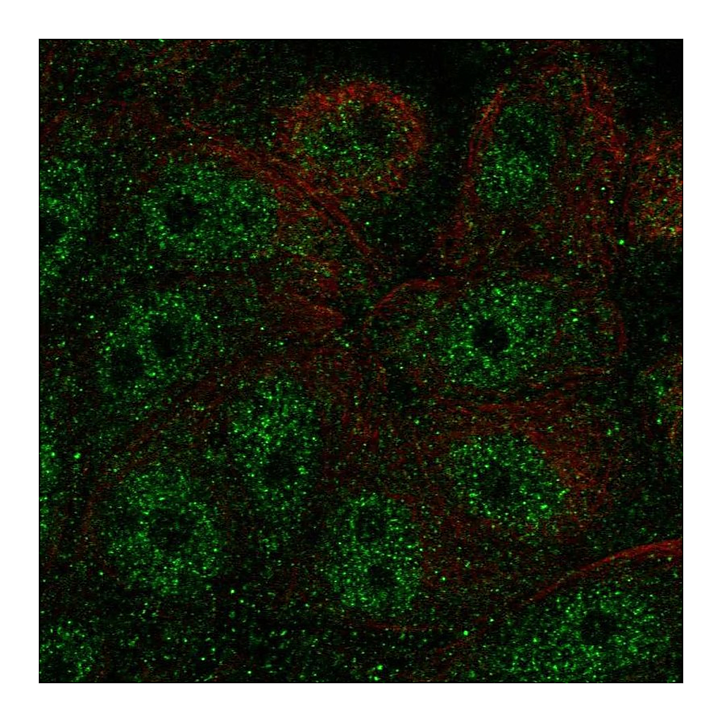 Atlas Antibodies Anti-FBP2 Antibody