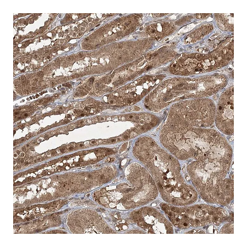 Atlas Antibodies Anti-FBXL17 Antibody
