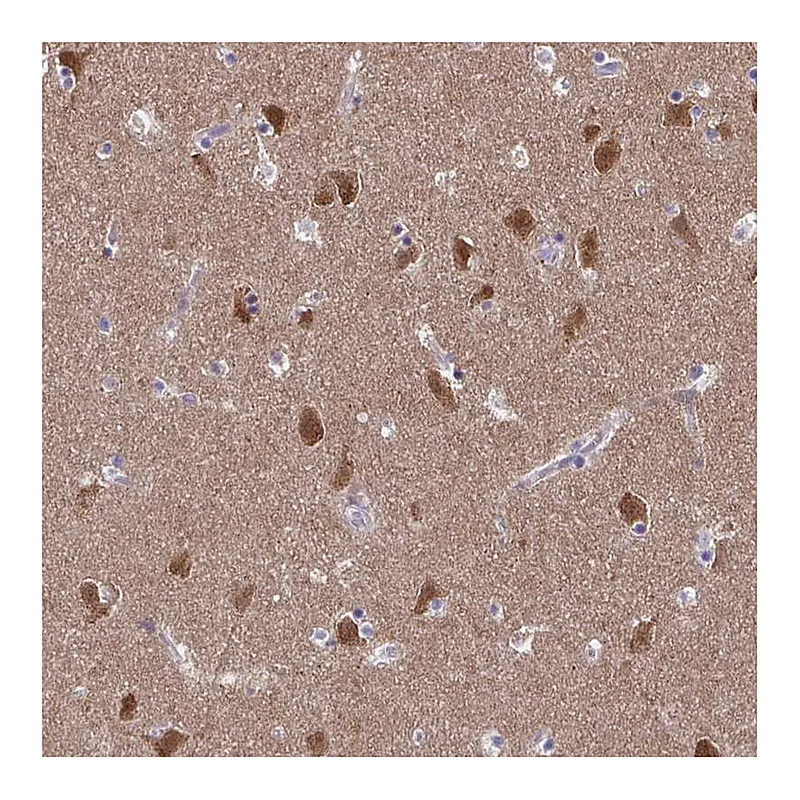 Atlas Antibodies Anti-FBXL16 Antibody