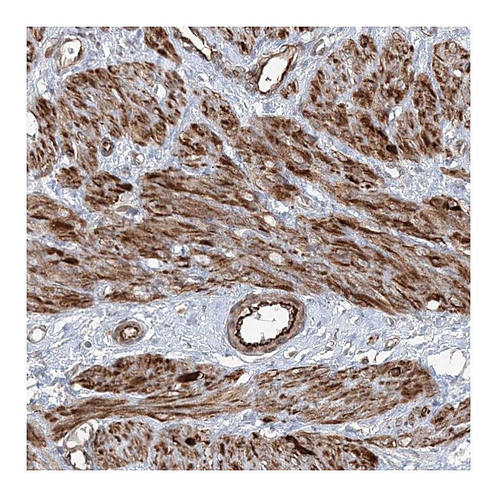 Atlas Antibodies Anti-FBXL17 Antibody
