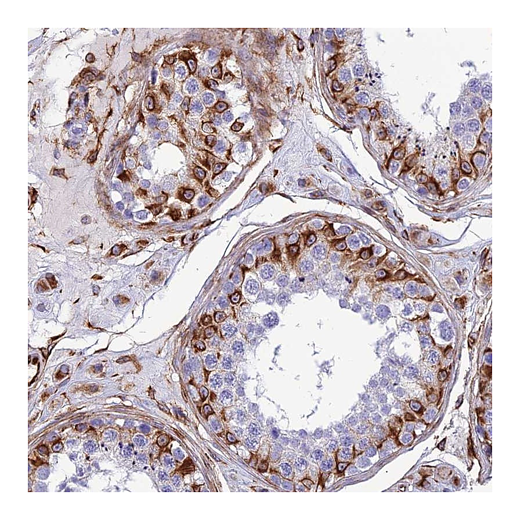 Atlas Antibodies Anti-FBXL20 Antibody