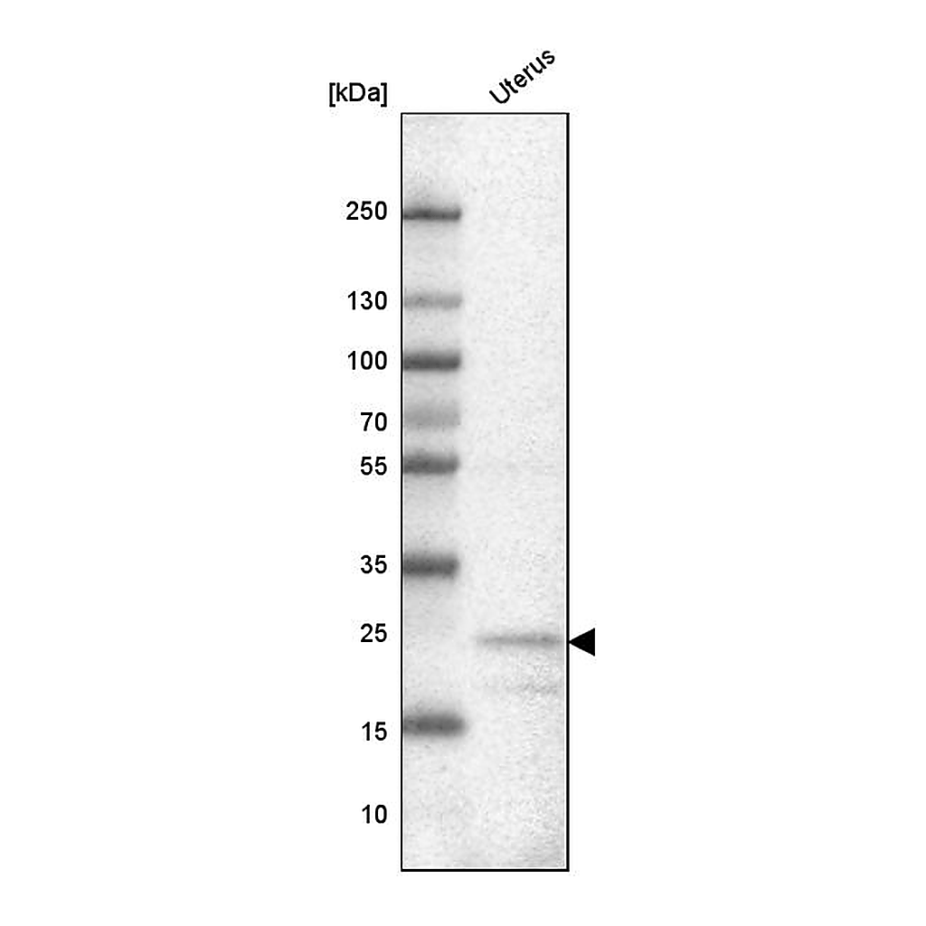 Atlas Antibodies Anti-FBXL22 Antibody