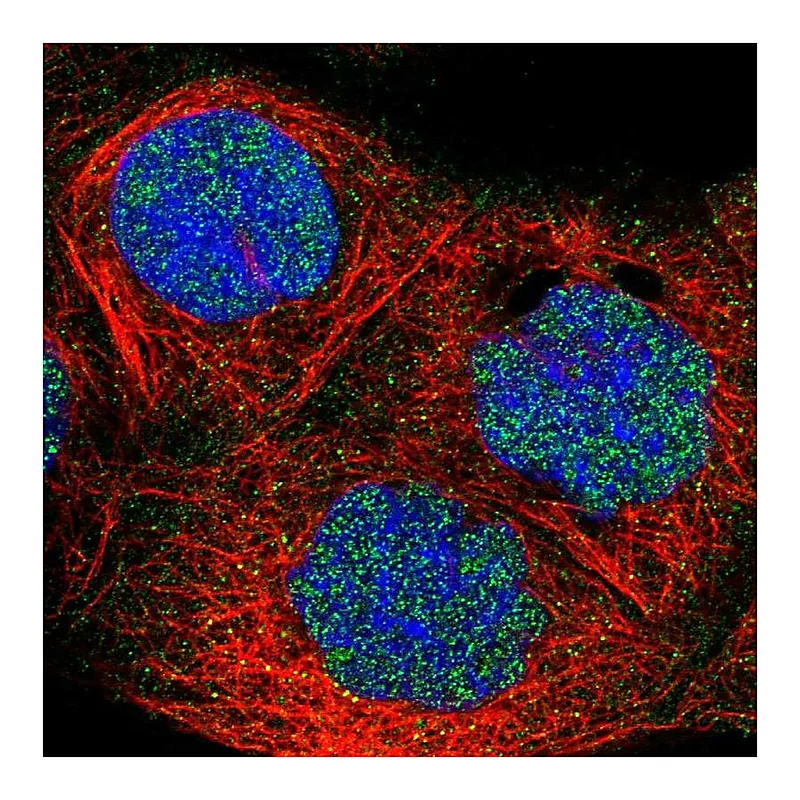 Atlas Antibodies Anti-FBXO11 Antibody