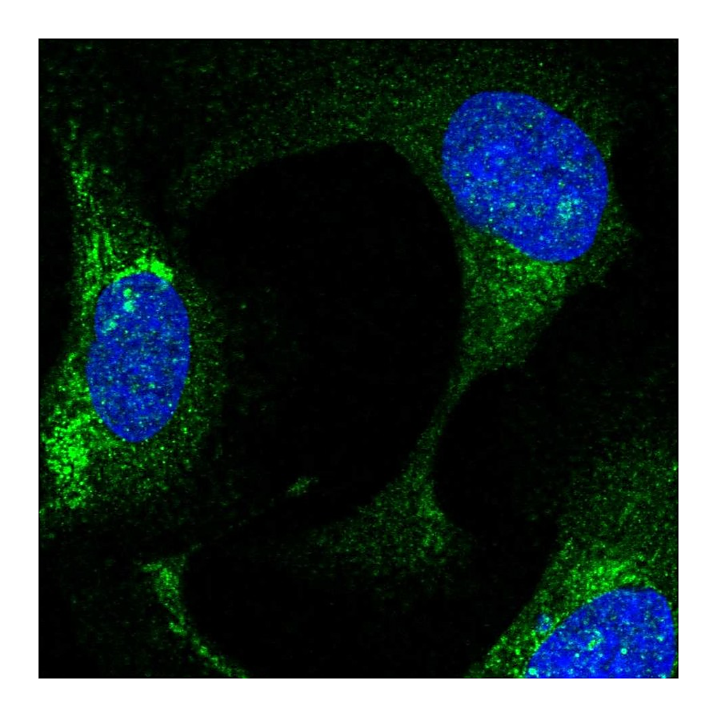 Atlas Antibodies Anti-FBXO21 Antibody