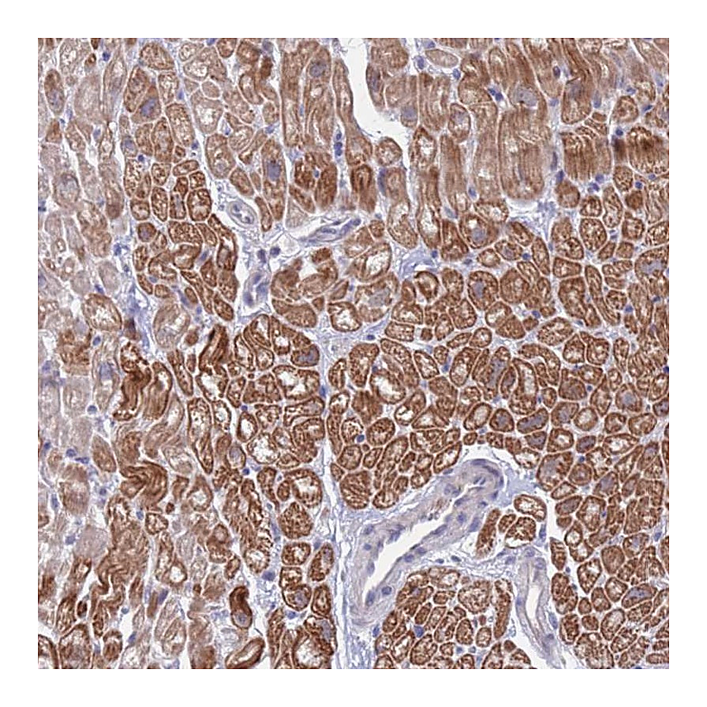 Atlas Antibodies Anti-FBXO27 Antibody