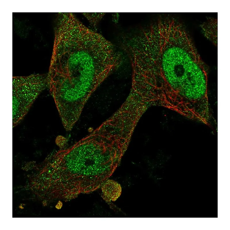 Atlas Antibodies Anti-FBXO32 Antibody