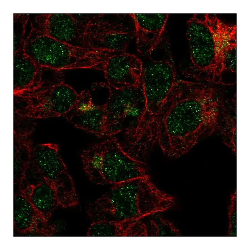 Atlas Antibodies Anti-FBXO31 Antibody