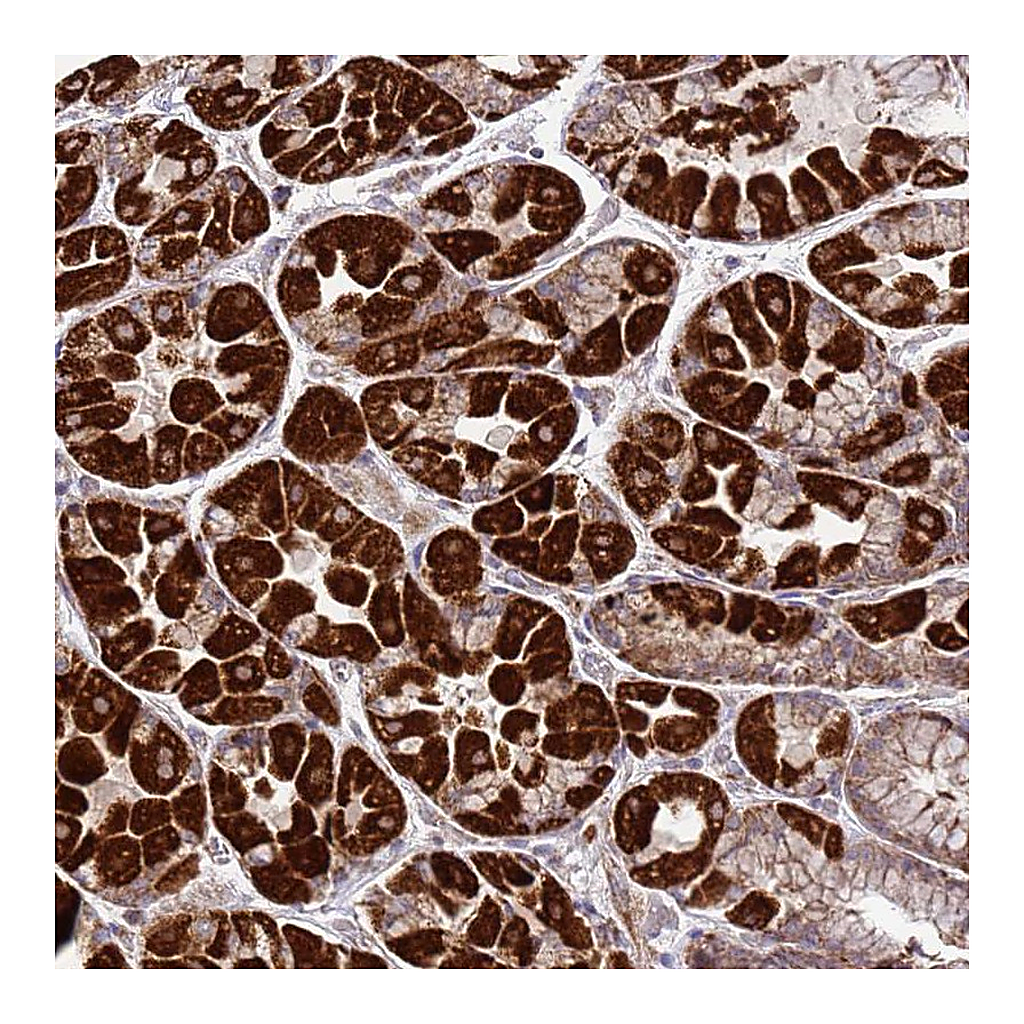 Atlas Antibodies Anti-FBXO33 Antibody