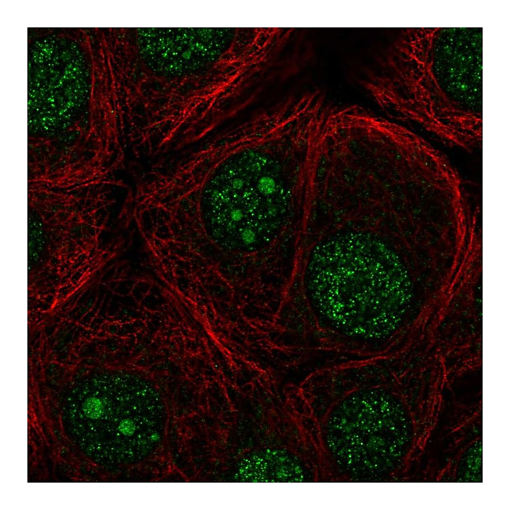 Atlas Antibodies Anti-FBXO36 Antibody