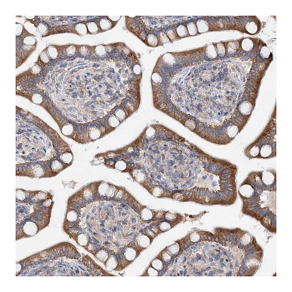 Atlas Antibodies Anti-FBXO38 Antibody