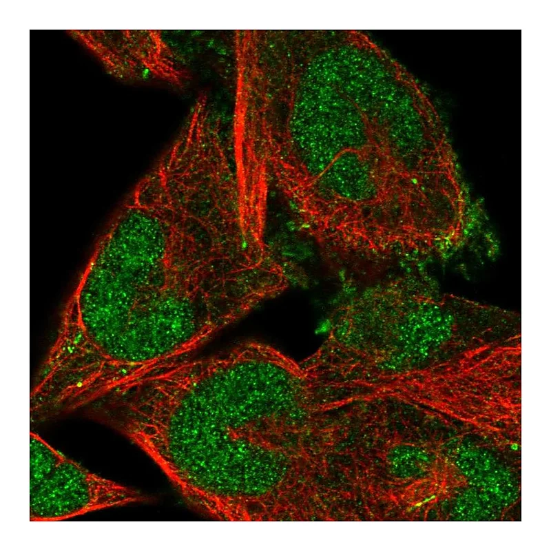 Atlas Antibodies Anti-FBXO41 Antibody