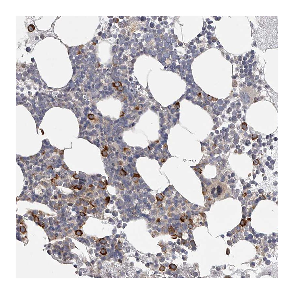 Atlas Antibodies Anti-FBXO43 Antibody