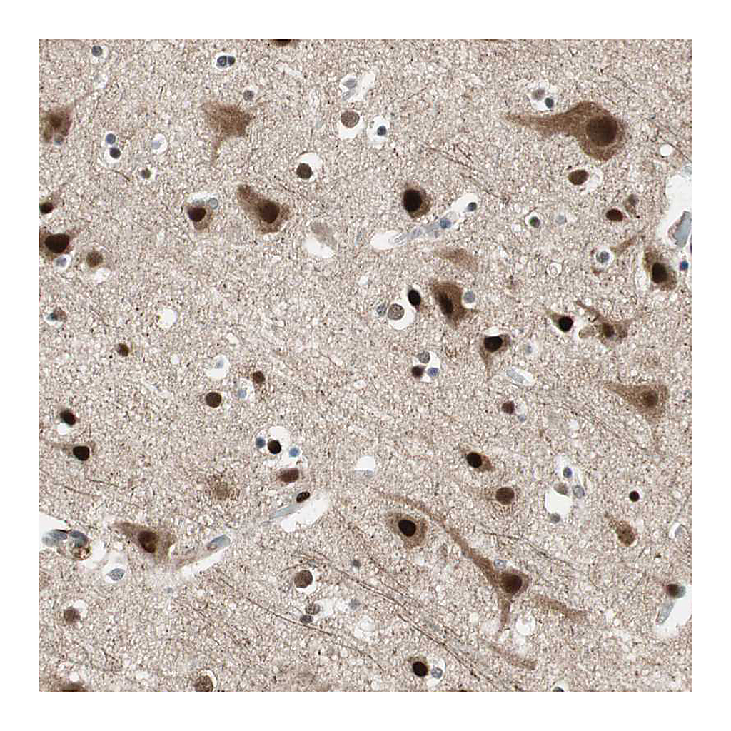 Atlas Antibodies Anti-FBXO44 Antibody
