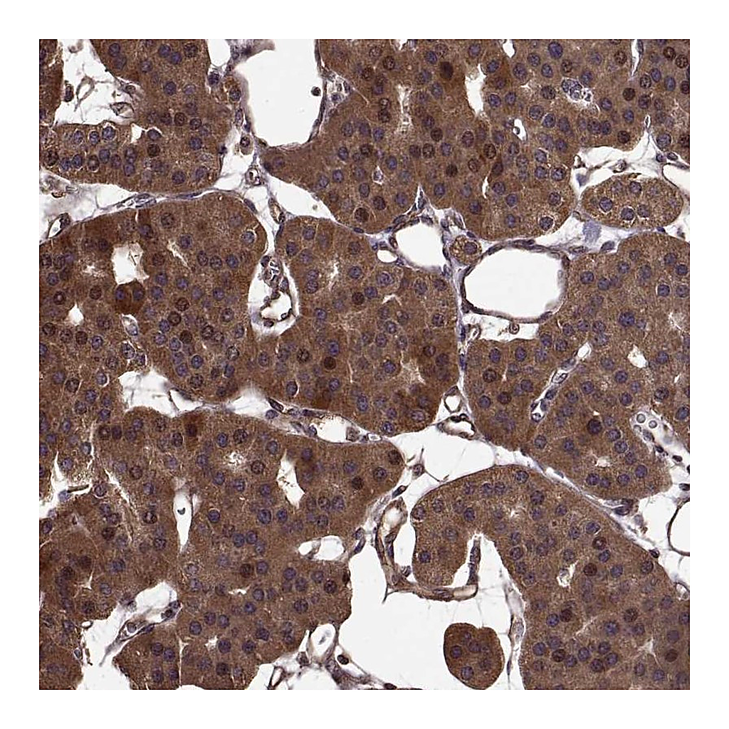 Atlas Antibodies Anti-FBXW11 Antibody