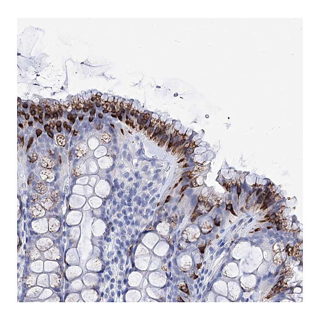 Atlas Antibodies Anti-FBXW12 Antibody