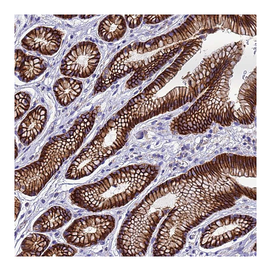 Atlas Antibodies Anti-FBXW5 Antibody