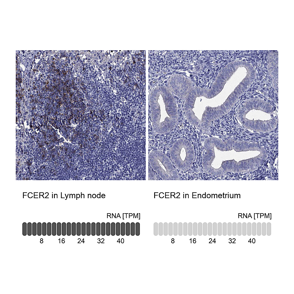 Atlas Antibodies Anti-FCER2 Antibody