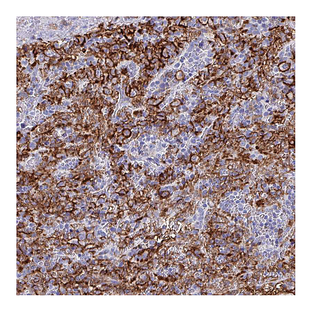 Atlas Antibodies Anti-FCGR3A Antibody