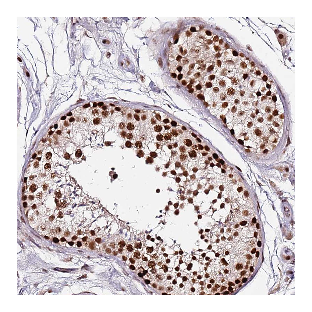 Atlas Antibodies Anti-FCF1 Antibody