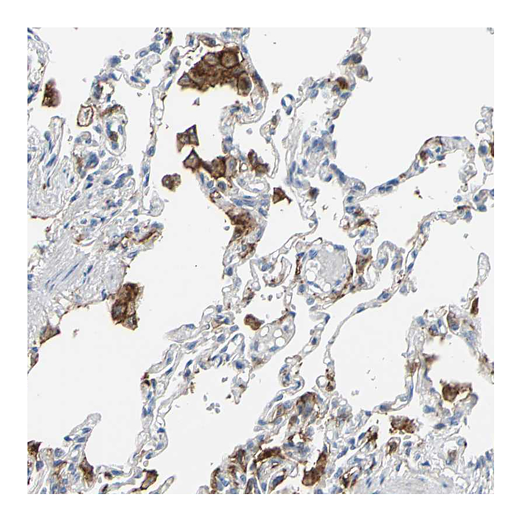 Atlas Antibodies Anti-FCGR2A Antibody