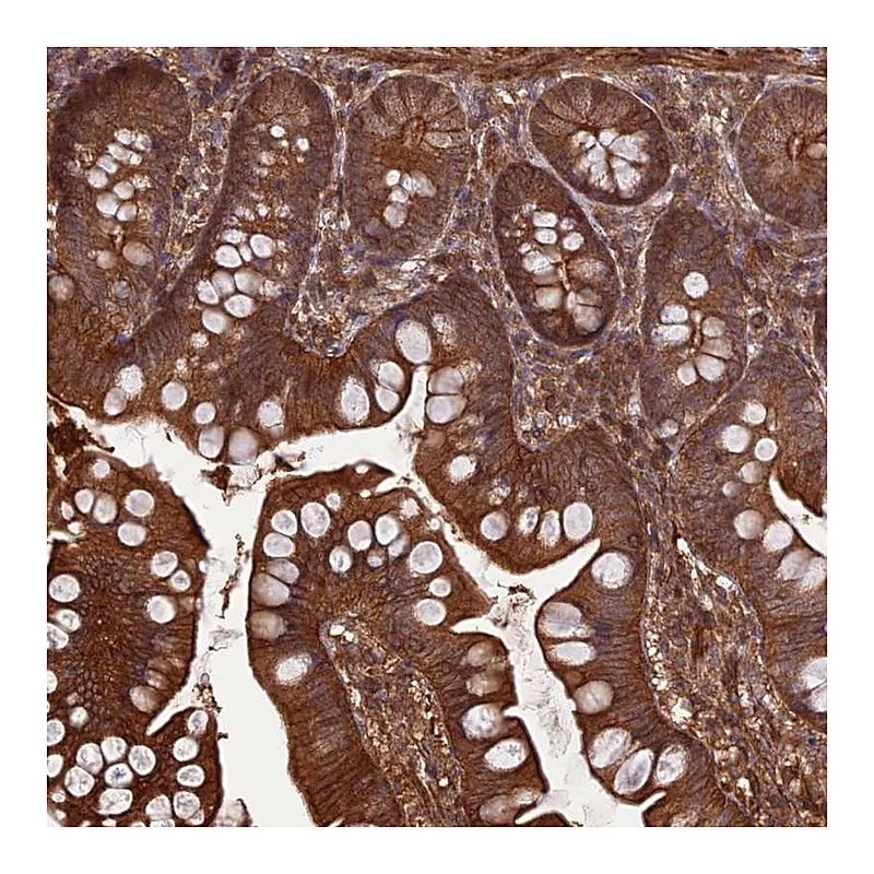 Atlas Antibodies Anti-FCHSD1 Antibody