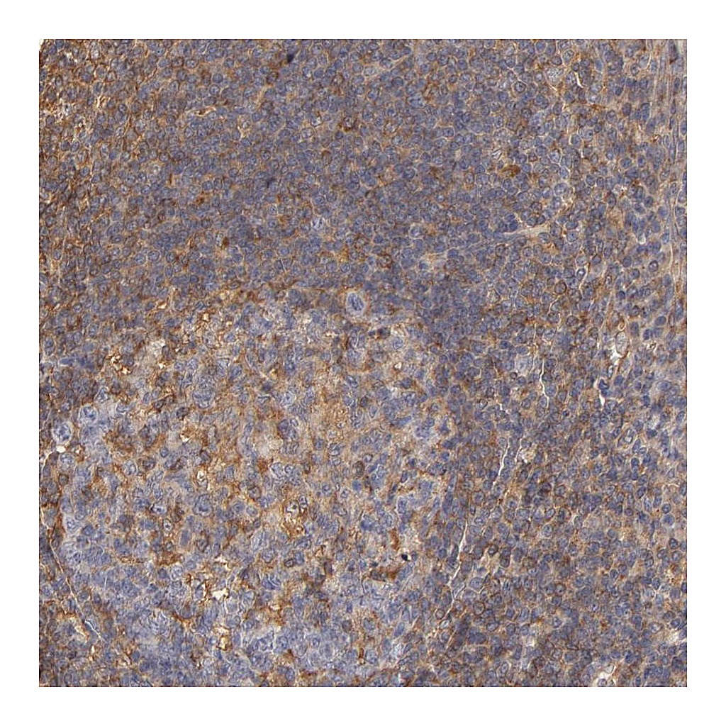 Atlas Antibodies Anti-FCMR Antibody