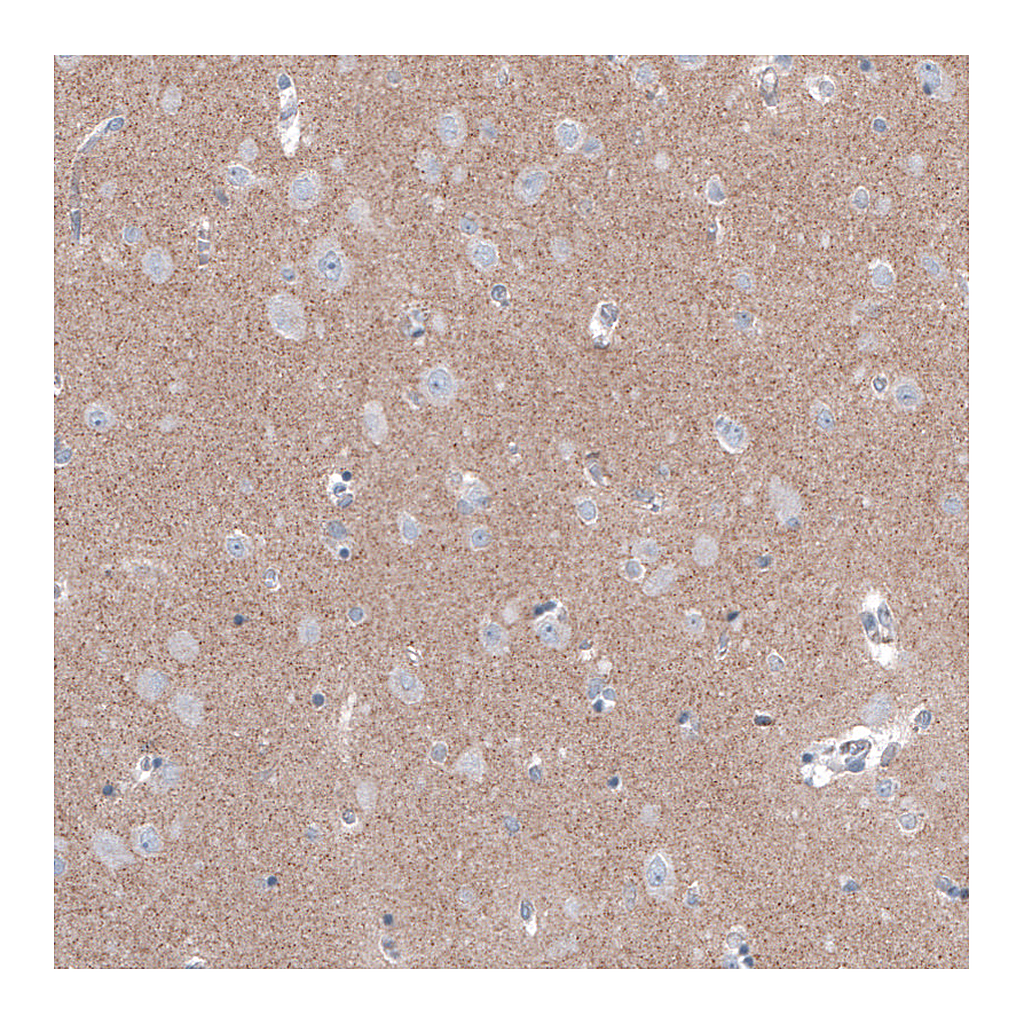 Atlas Antibodies Anti-FCHSD2 Antibody