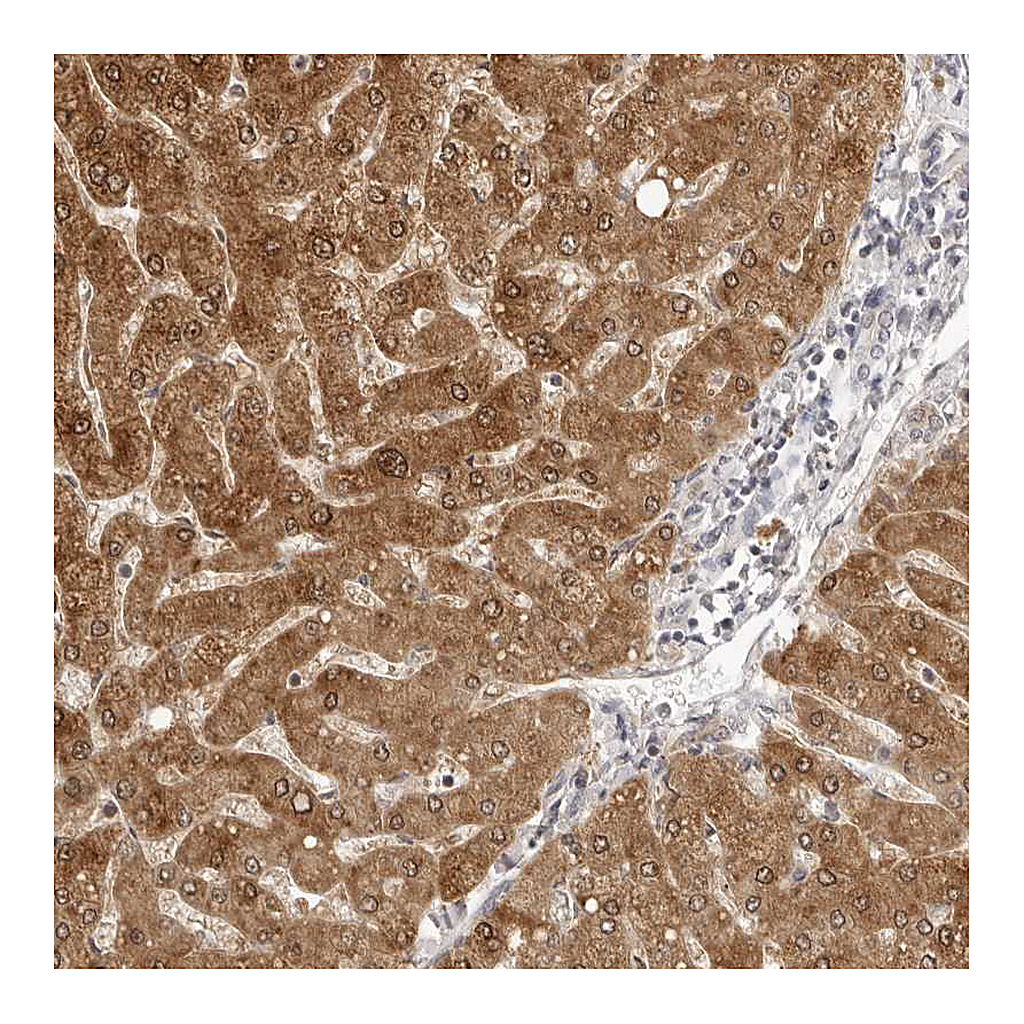 Atlas Antibodies Anti-FDPS Antibody