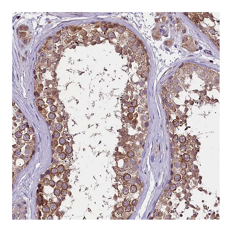 Atlas Antibodies Anti-FEM1B Antibody