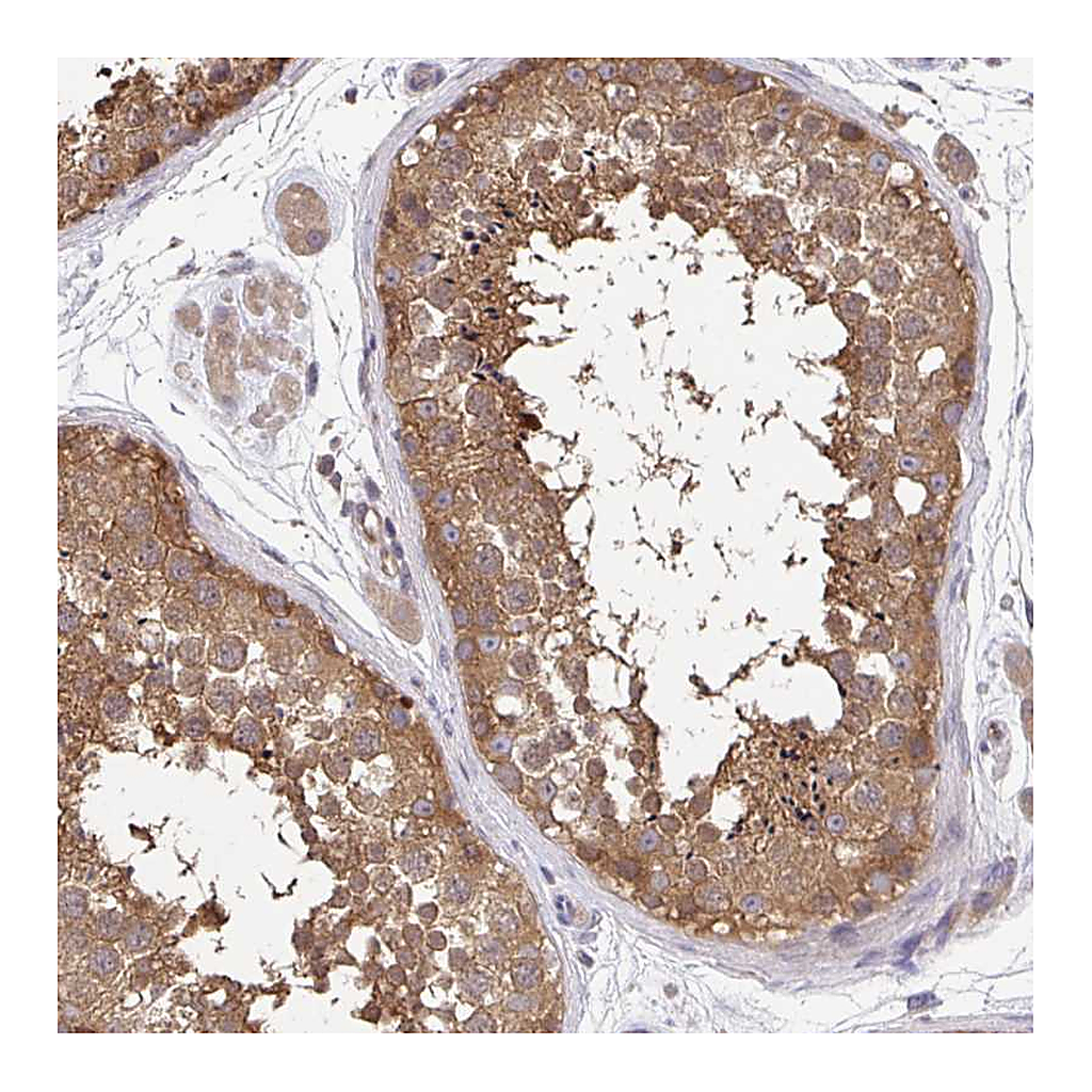 Atlas Antibodies Anti-FEM1C Antibody