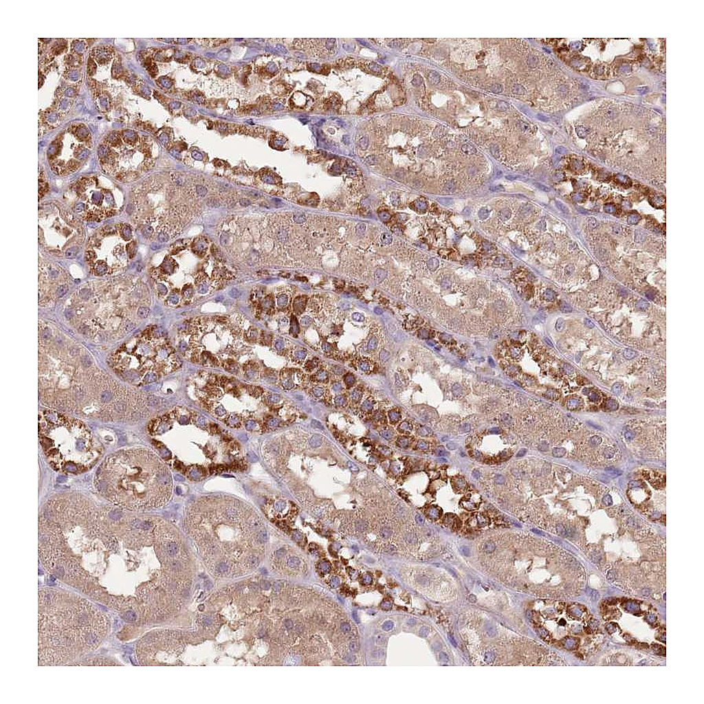 Atlas Antibodies Anti-FECH Antibody