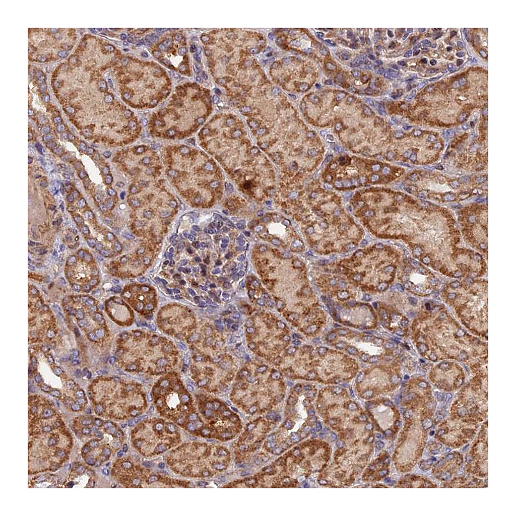 Atlas Antibodies Anti-FERMT1 Antibody