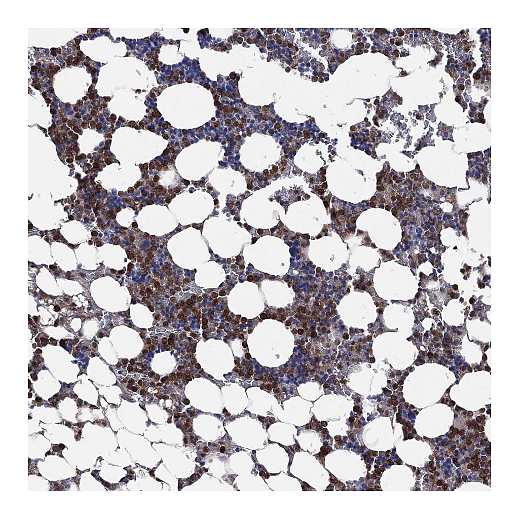 Atlas Antibodies Anti-FES Antibody