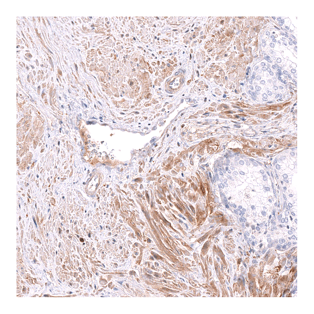 Atlas Antibodies Anti-FERMT2 Antibody