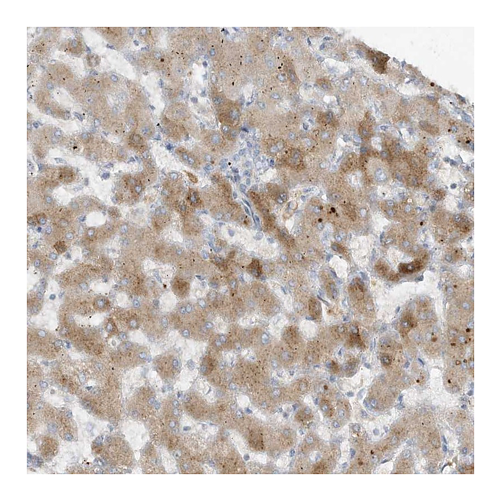 Atlas Antibodies Anti-FETUB Antibody